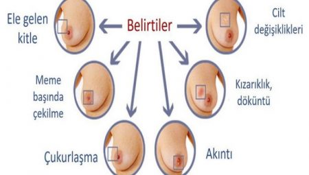 Meme kanserinde erken teşhis hayat kurtarıyor