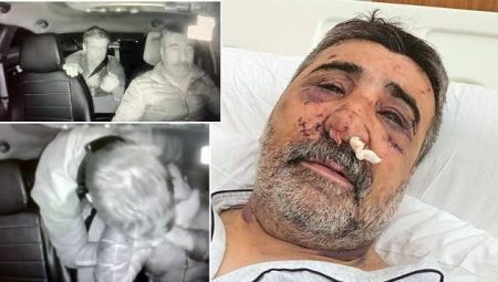 İngiliz boksörün dehşeti yaşattığı taksici konuştu: Ellerini gözüme sokmaya, ısırmaya, öpmeye başladı