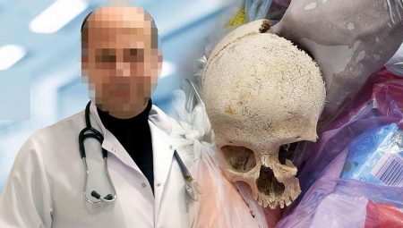 Adana’daki çöpten kafatası çıkmıştı! Tabibin yıllardır sakladığı sır