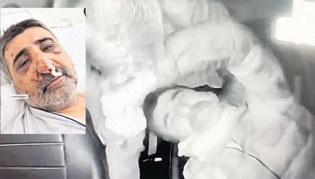 Boksörün dövdüğü taksicinin ailesi: Türkiye’de yargılansın