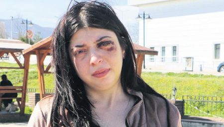 Tacizin bıraktığı yara: Platinler