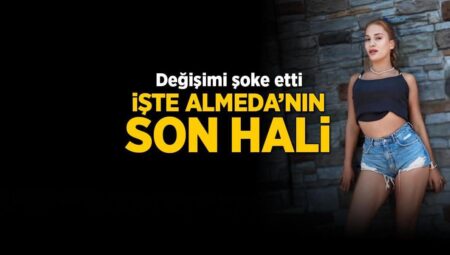 Survivor Almeda burun ameliyatı akabinde son halini paylaştı! Değişimi şoke etti