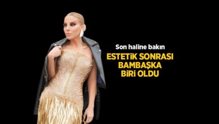 Bıçak altına yatan Gülşah Saraçoğlu apayrı biri oldu! Estetik sonrası son haline bakın
